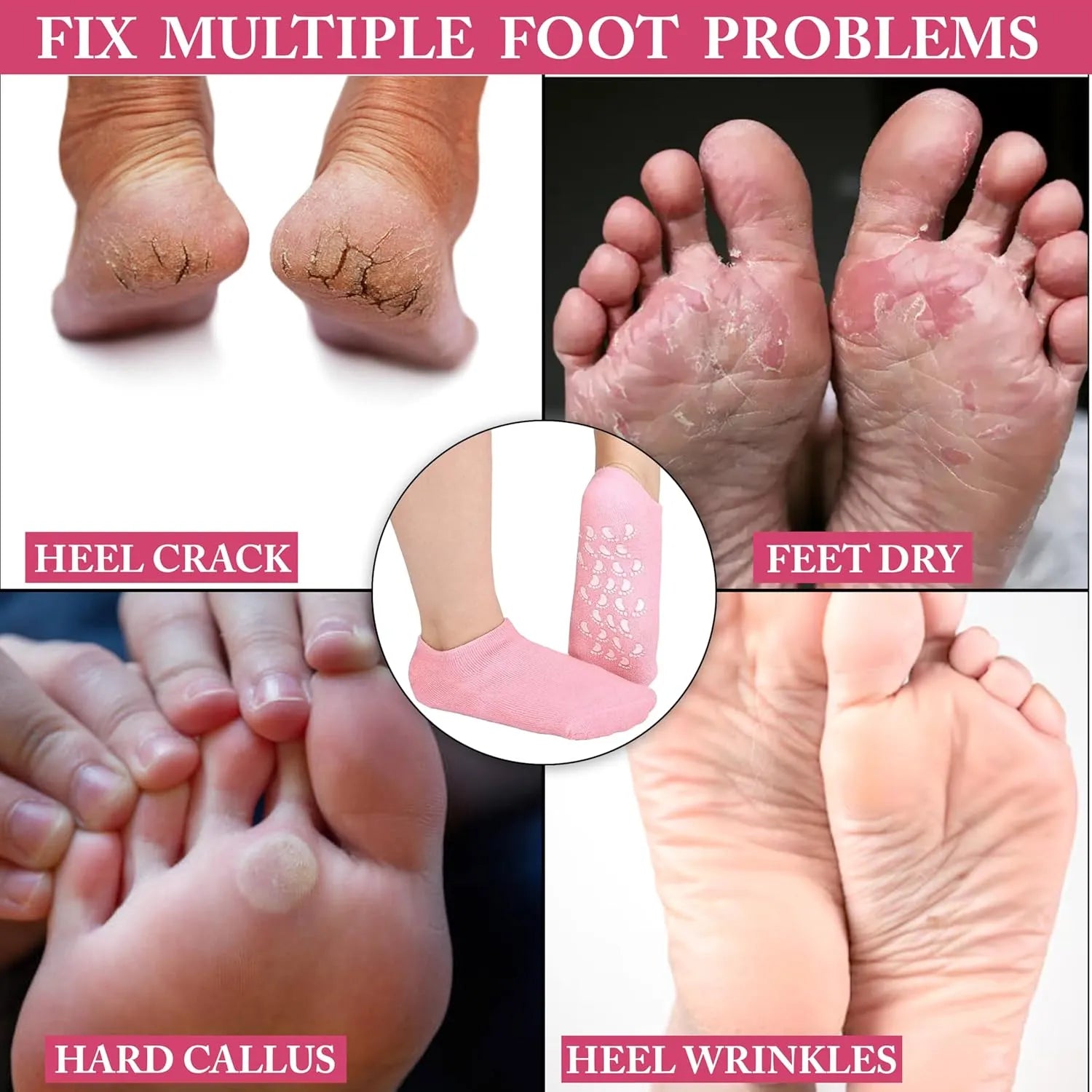 Silicone Moisturizing Gel Socks - Pair